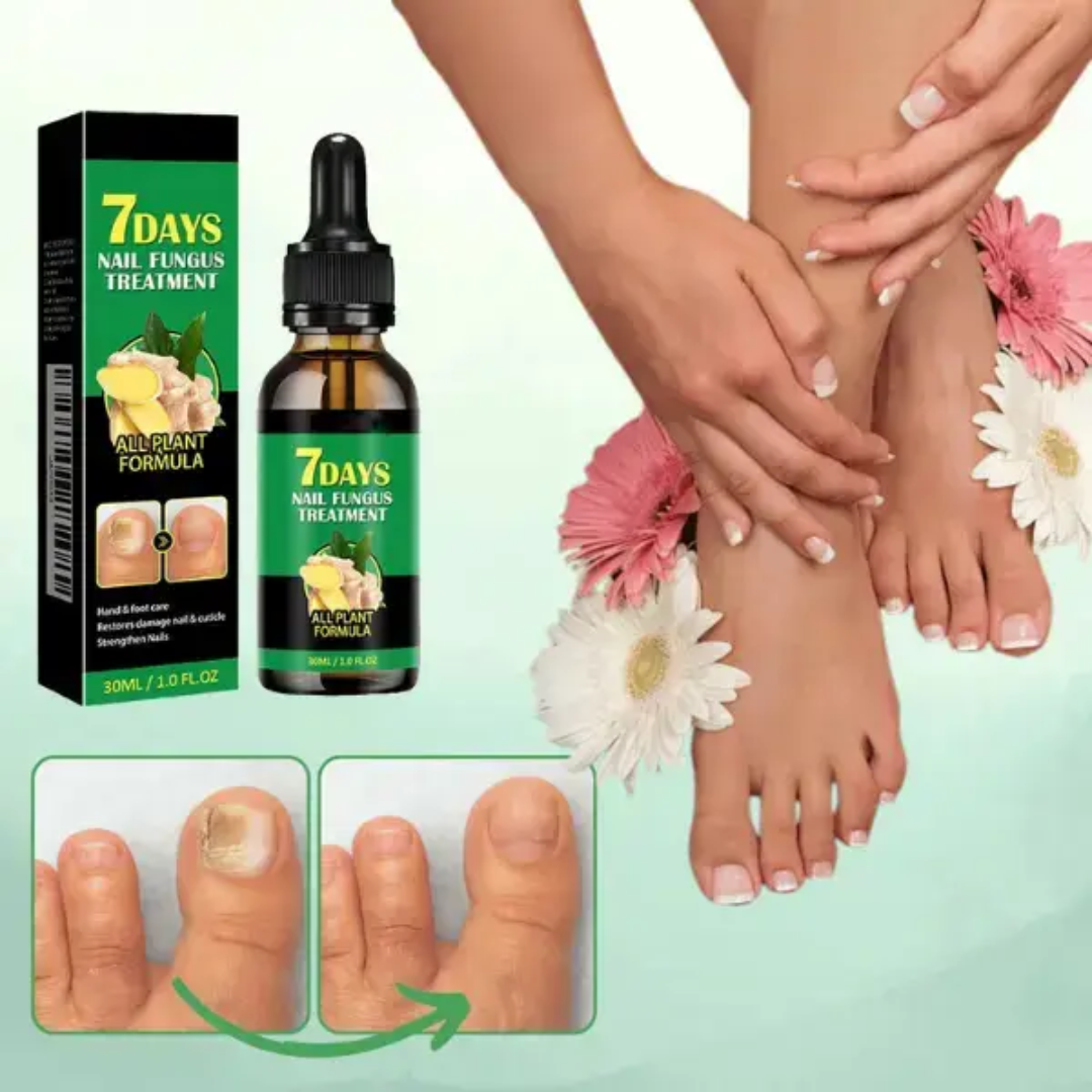 🧴 Aceite Antihongos 7DAYS™ | ¡Oferta 2x1 Disponible!