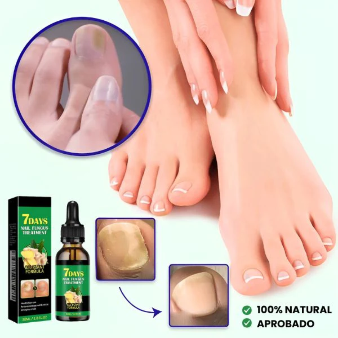 🧴 Aceite Antihongos 7DAYS™ | ¡Oferta 2x1 Disponible!
