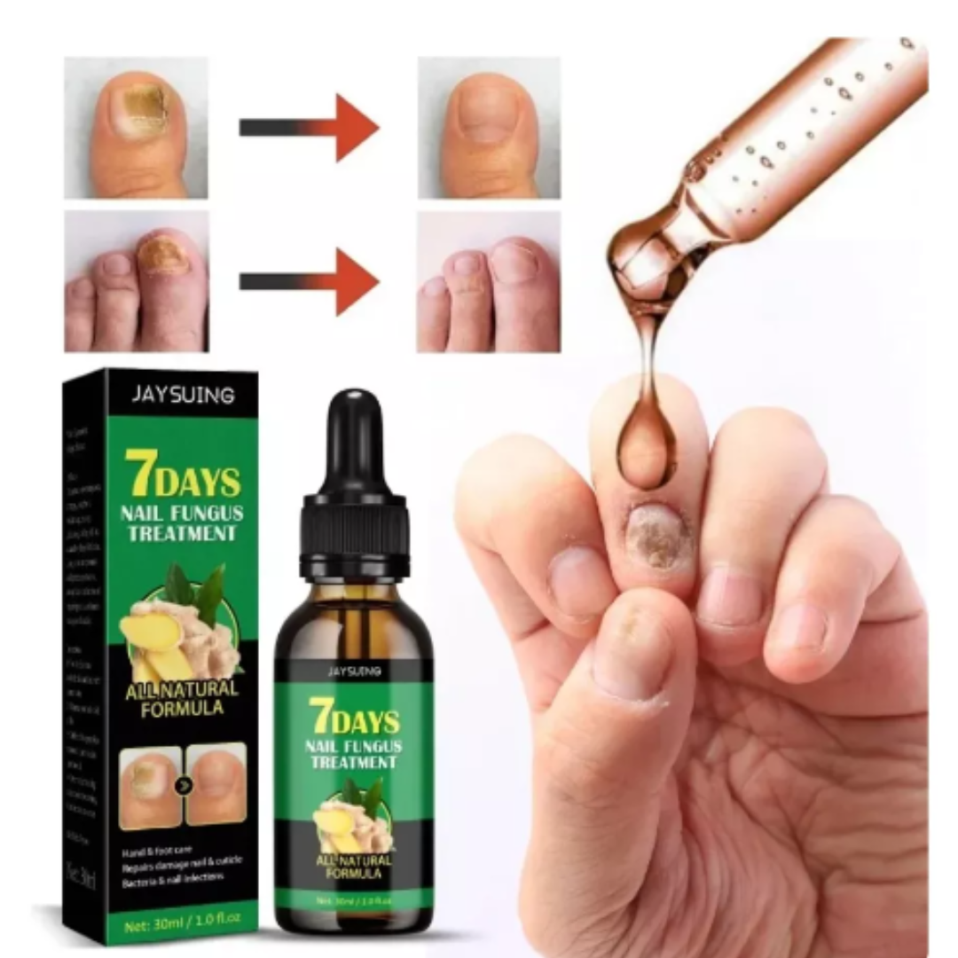 🧴 Aceite Antihongos 7DAYS™ | ¡Oferta 2x1 Disponible!